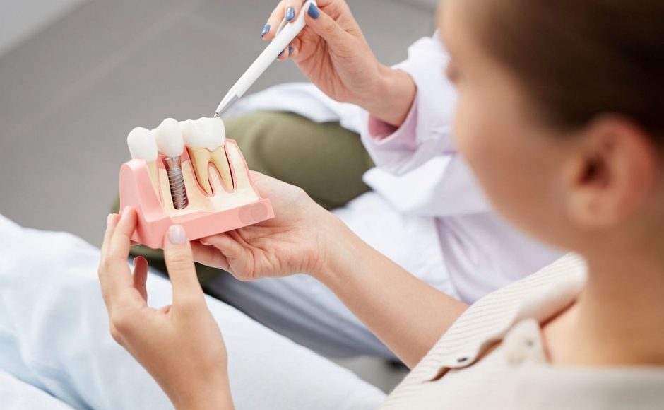 Top 5 Reasons For High Quality Dental Implants